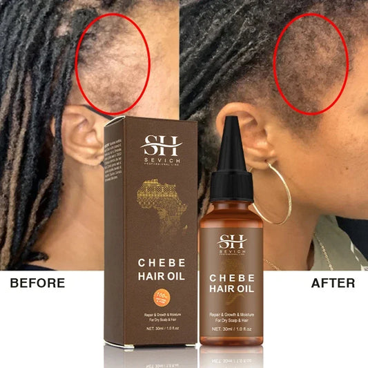 Hair Growth Chebe  Oil Anti-Hair Loss Treatment Fast Growing Products Repair Damage Dry Hair Care Essential Oils for Men Women