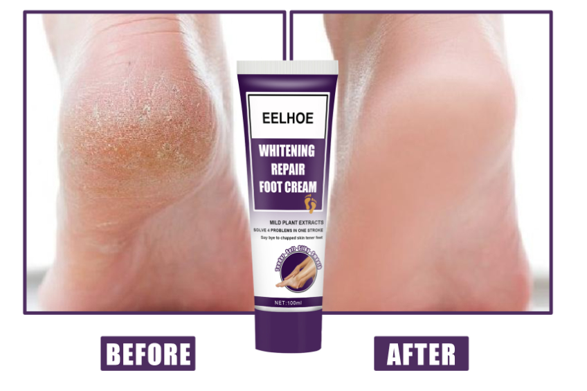 Foot Care Cream Moisturizes And Exfoliates Feet